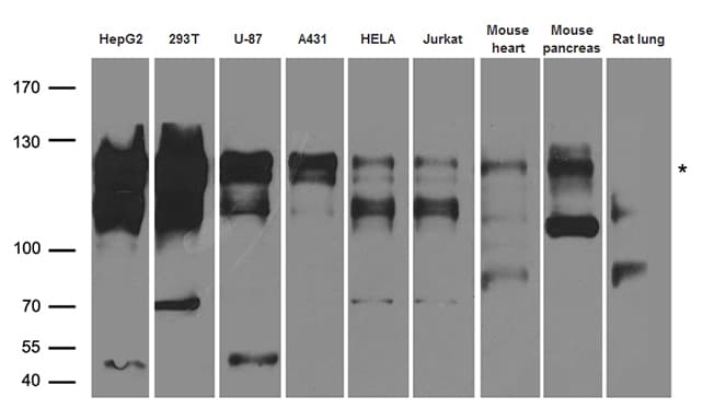 PPP6R2 / SAPS2 Antibody