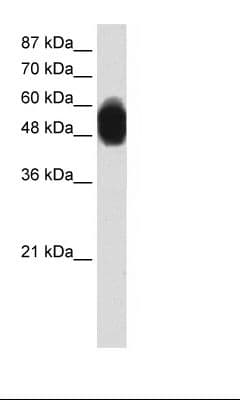 ZNF296 / ZNF342 Antibody (aa300-349)