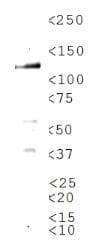 TRPM8 Antibody (Biotin)