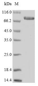 Human ENOX1 / CNOX Protein (Recombinant 10His, N-terminus + Myc, C-terminus)