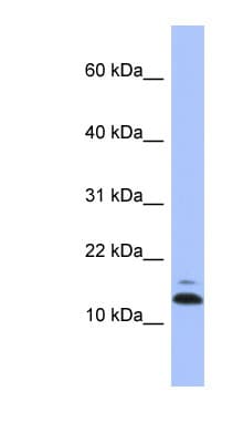 ASAH1 / Acid Ceramidase Antibody (N-Terminus)
