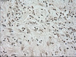 BUB1B / BubR1 Antibody (clone OTI5D9)