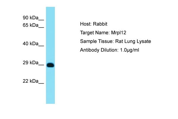 MRPL12 Antibody (aa119-168)