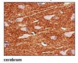 SLC1A2 / EAAT2 / GLT-1 Antibody (C-Terminus)