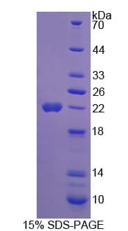 Human GH2 Protein (Recombinant His)