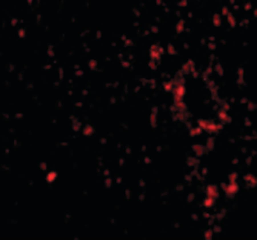 IHC-plus™ Polyclonal Rabbit anti-Human TEM7 Antibody (IHC, IF, WB)
