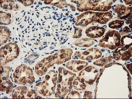 CLPP Antibody (clone OTI1C7)