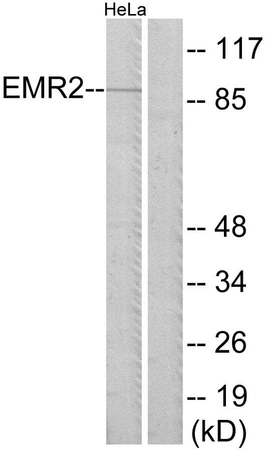Polyclonal Rabbit anti-Human ADGRE2 / EMR2 Antibody (WB)