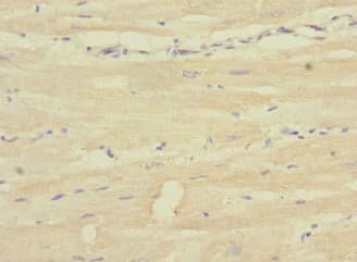 Polyclonal Rabbit anti-Human SH3D19 Antibody