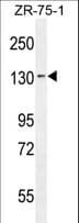 TLL1 Antibody (aa874-901)