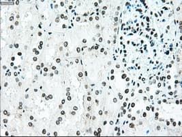 BRAF / B-Raf Antibody (clone OTI4C5)