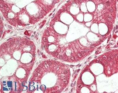 IHC-plus™ Raptor / Mip1 Antibody (aa1-50)