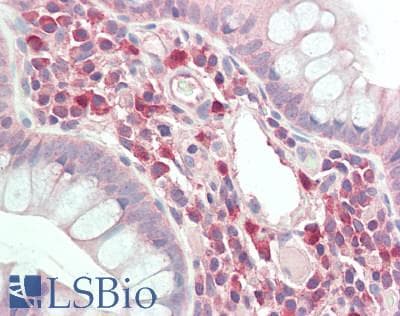 IHC-plus™ SIK3 / QSK Antibody (aa900-950)