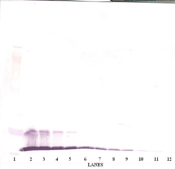 CCL2 / MCP1 Antibody