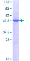 Human OIP5 Protein (Recombinant GST)