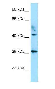 ATCAY / CLAC Antibody (C-Terminus)