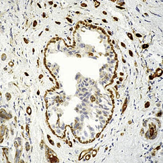 TGM2 / Transglutaminase 2 Antibody (clone CUB7402)