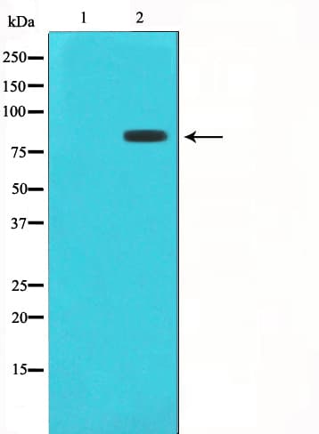 STAT1 Antibody (phospho-Ser727)