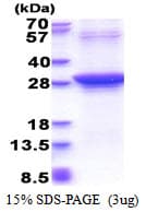 Human RAD51L3 / RAD51D Protein (Recombinant His)