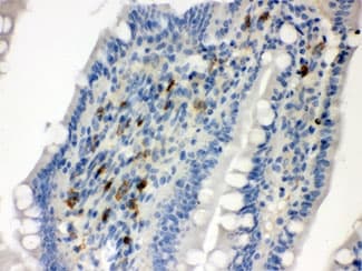SDC4 / Syndecan 4 Antibody