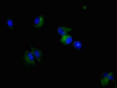 NES / Nestin Antibody (clone 2G2F7)