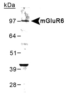 GRM6 / MGLUR6 Antibody (aa859-871)