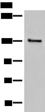 SASH1 Antibody