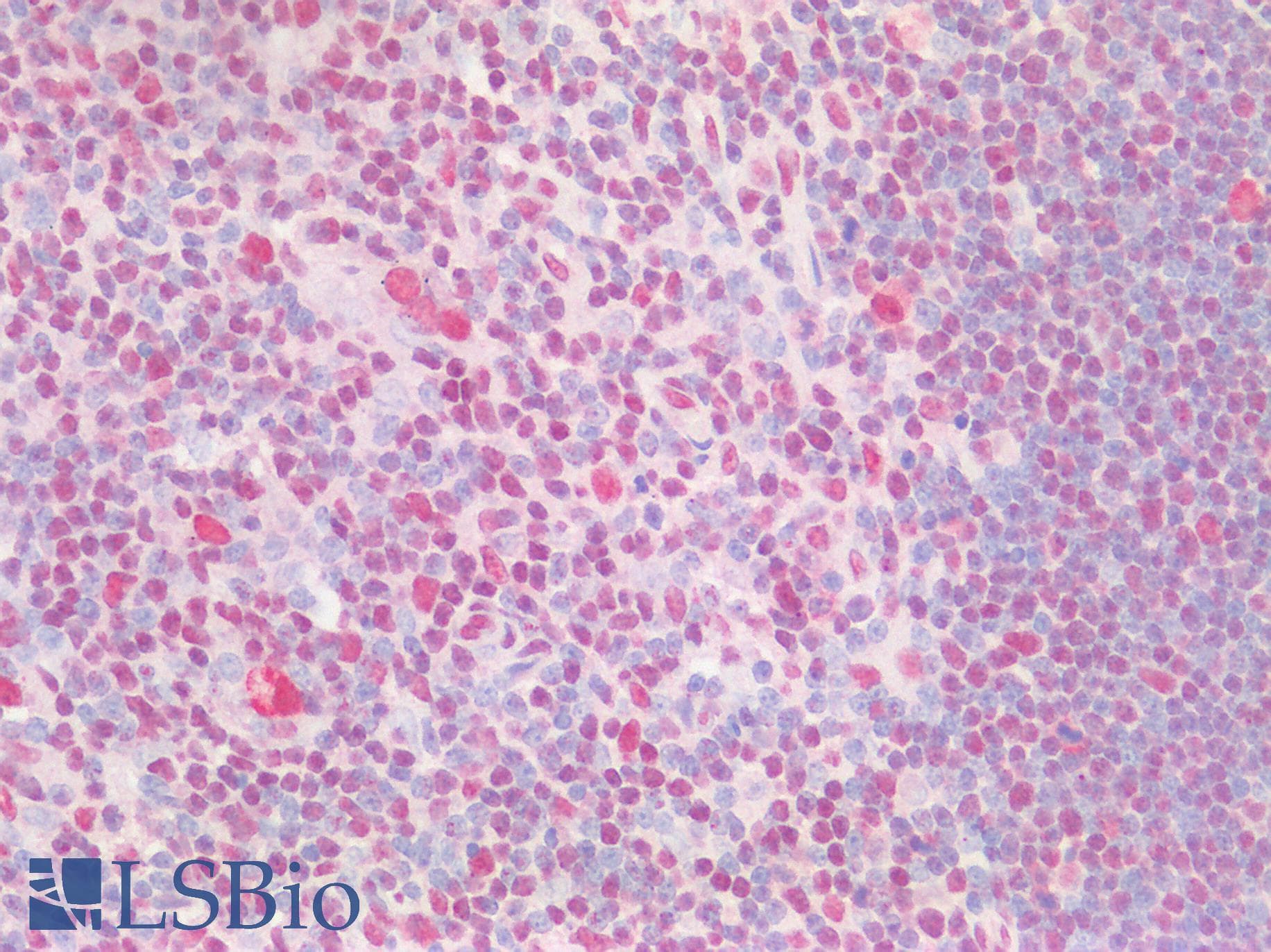 AATF Antibody (aa171-220)
