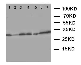 AQP9 / Aquaporin 9 Antibody (aa263-278)