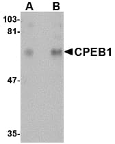 CPEB1 / CPEB Antibody