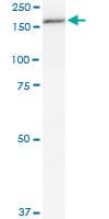 PathPlus™ MPO / Myeloperoxidase Antibody (clone 3E11)