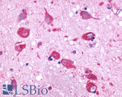 PathPlus™ Polyclonal Rabbit anti-Human GPR150 Antibody (N-Terminus, IHC)