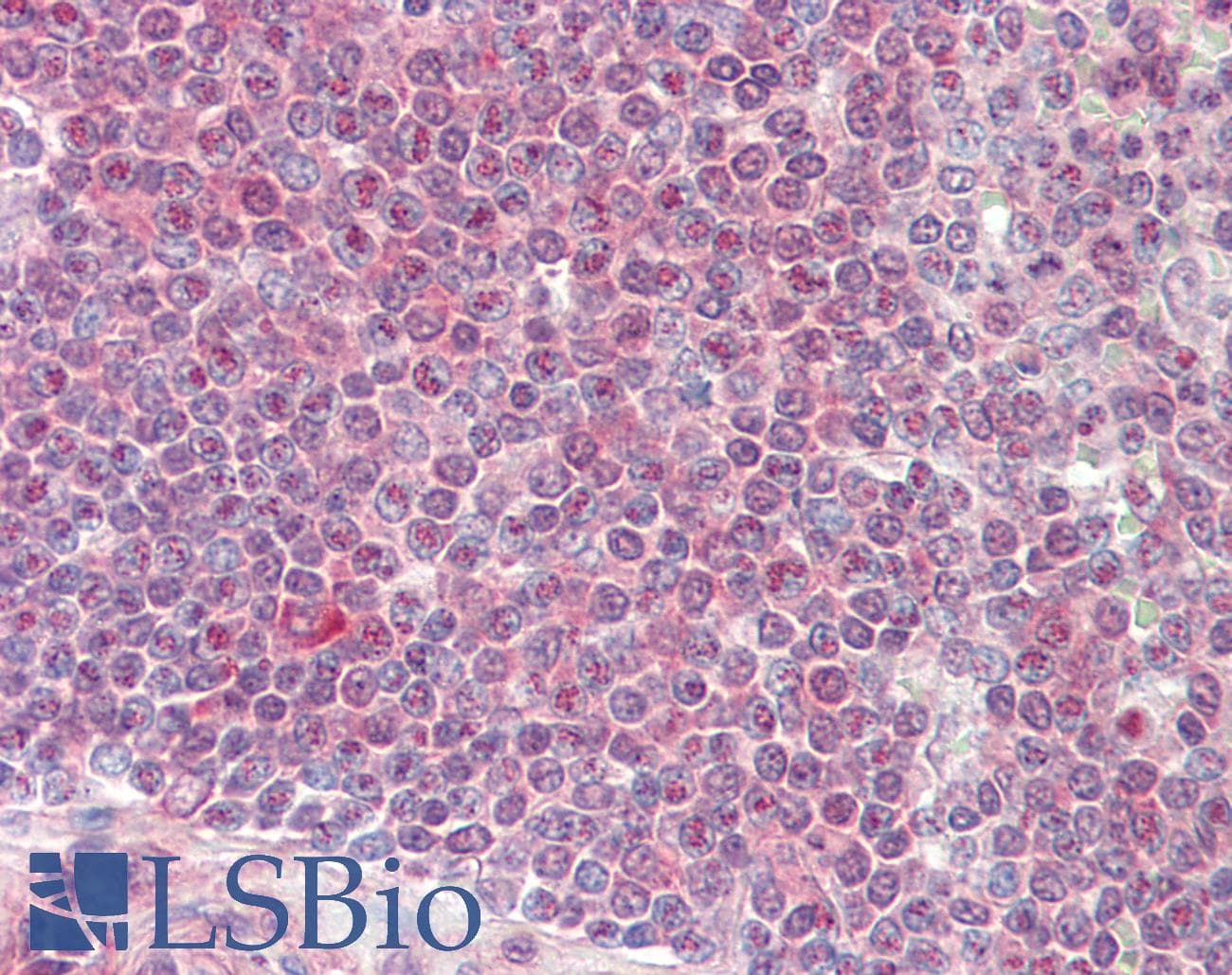 IHC-plus™ A1CF / ACF Antibody