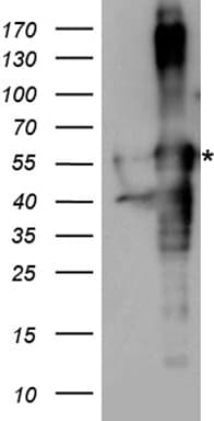 ARA55 / HIC-5 Antibody