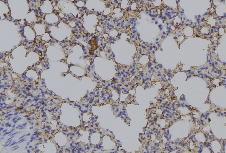 Polyclonal Rabbit anti-Human AMACR / P504S Antibody (IHC, IF, WB)