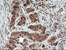 FBXO21 Antibody (clone OTI2C7)