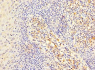 IHC-plus™ ITGAE / CD103 Antibody