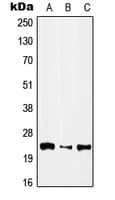 IFNA1 / Interferon Alpha 1 Antibody (Internal)