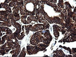 ARMC1 Antibody (clone OTI1D10)
