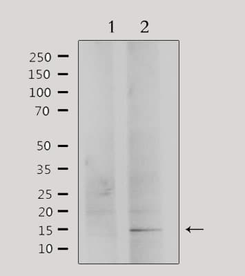 Polyclonal Rabbit anti-Human PHLDA2 / TSSC3 Antibody (IHC, WB)