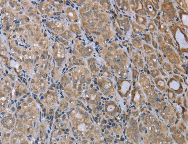 Polyclonal Rabbit anti-Human MAPRE3 / EB3 Antibody (IHC, WB)