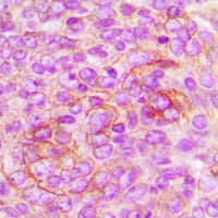 IGF2R / CD222 Antibody (C-Terminus)