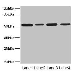CD276 / B7-H3 Antibody