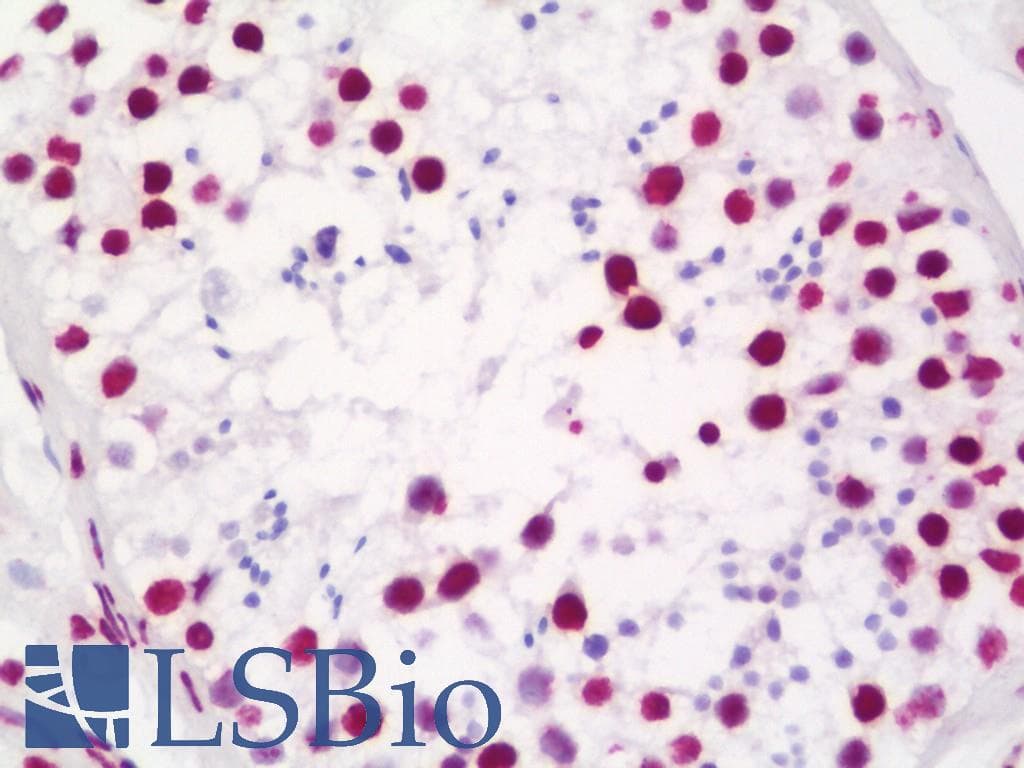 IHC-plus™ Polyclonal Rabbit anti-Human MATR3 / Matrin 3 Antibody (aa800-C-term, IHC, IF)