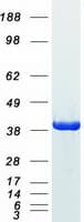 Human GAPDH Protein (Recombinant Myc-DDK (Flag))