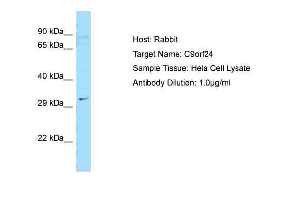 Polyclonal Rabbit anti-Human C9orf24 Antibody (N-Terminus, WB)