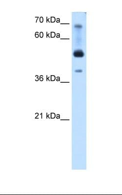 TFAP2B / AP2 Beta Antibody (N-Terminus)
