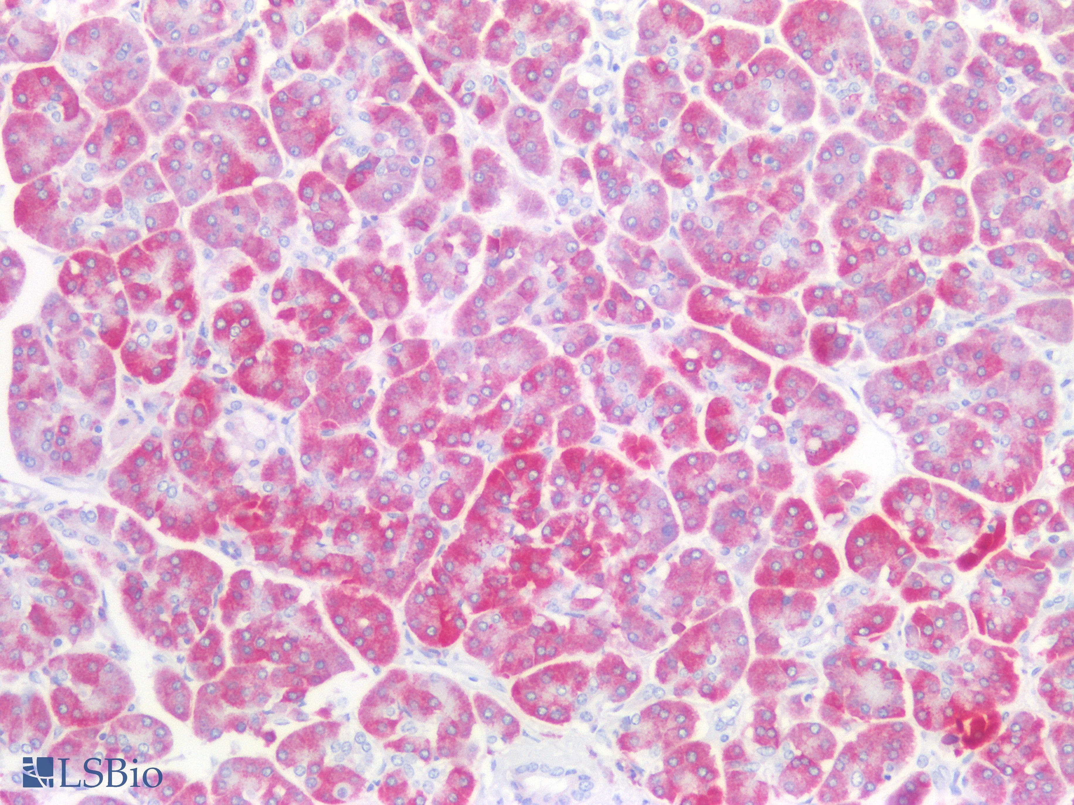PathPlus™ RPS2 / Ribosomal Protein S2 Antibody