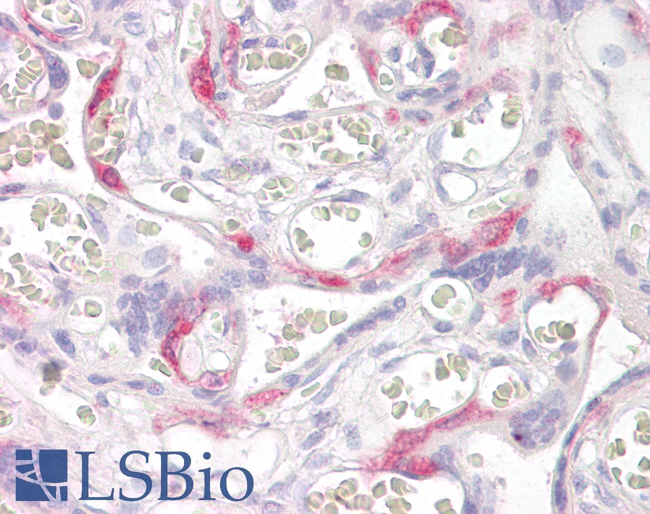 IHC-plus™ Polyclonal Goat anti-Human PHLDA2 / TSSC3 Antibody (aa139-152, IHC)