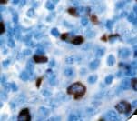 Monoclonal Mouse Anti-Human Lambda Light Chain Secondary Antibody (IHC)